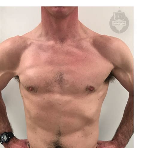 test for pec major tear|pectoralis major strain test.